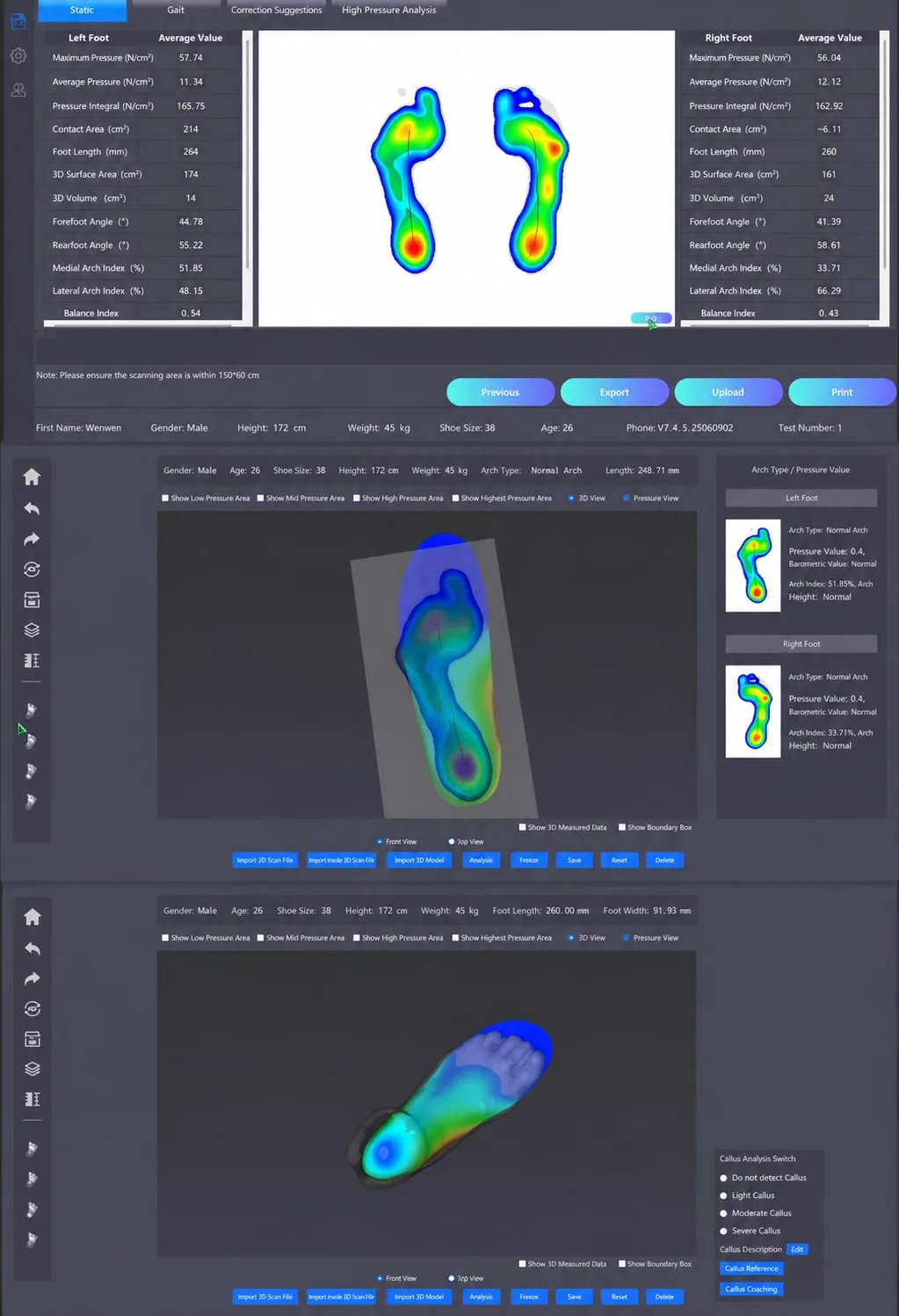 Foot-scan and plantar-pressure analysis software used to shape the CRBN V2 plate to the foot